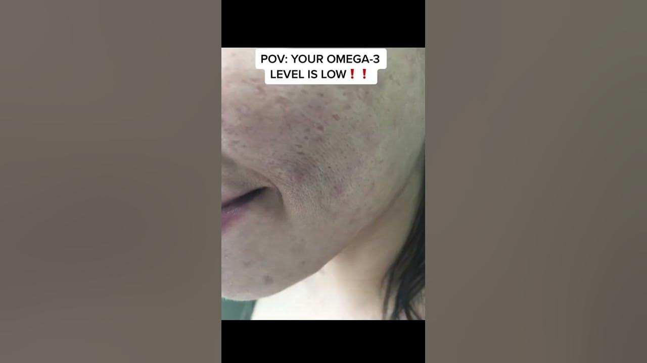 Is your OMEGA3 level LOW?!!!! skincareroutine skincare YouTube