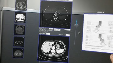 An Augmented Reality Application for Endovascular Aortic Repair Procedures