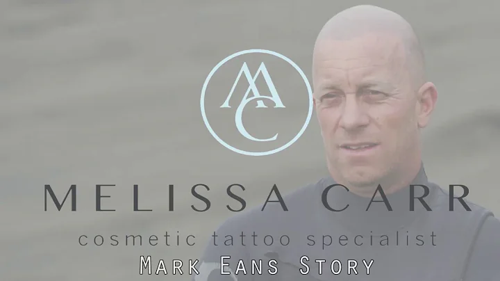 Mark's Scalp Micropigmentatio...  | Melissa Carr C...