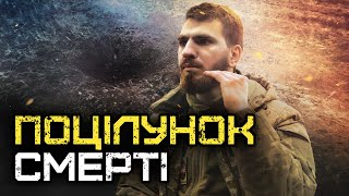 Куля торкнулась моєї губи | ГОЛОС ВІЙНИ