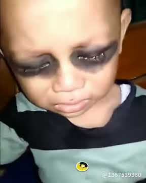 Akibat anak terlalu sering main HP