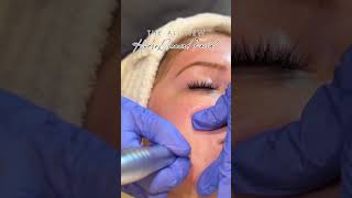 ✨ Meet the HydroDiamond Facial ✨