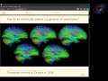 Structural connectome atlas construction in the space of Riemannian metrics