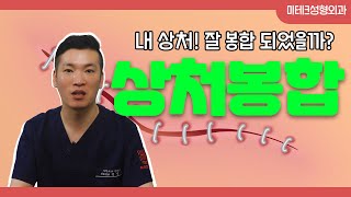 상처 봉합은 그냥 꿰매면 끝 아닌가요? #부산열상봉합 #부산상처봉합 #미세융기봉합