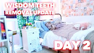 WISDOM TEETH REMOVAL UPDATE DAY 2 (SWOLLEN) | Family 5 Vlogs