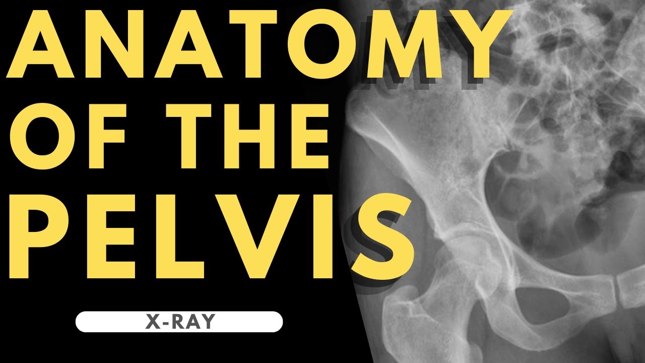 Pelvis, Radiology Reference Article