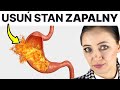 To powoduje stan zapalny w odku i dwunastnicy 