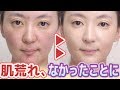 荒れた肌、ベースメイクで何とかできる！ の動画、YouTube動画。