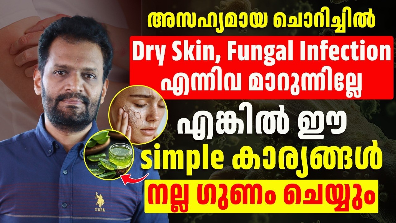 നിങ്ങളുടെ ചൊറിച്ചിൽ പൂർണ്ണമായി മാറ്റാൻ ഈ സിംബൽ കാര്യങ്ങൾ മാത്രം ചെയ്താൽ മതി