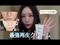 韓国薬局で見つけた最強再生クリーム🍦⭐︎皮膚科での施術後の赤みにはコレ‼️