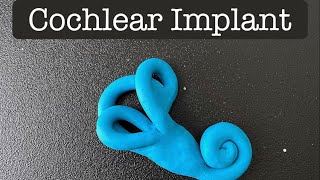 Playdough Surgery 🔪🐌🦻🏾- Cochlear Implant