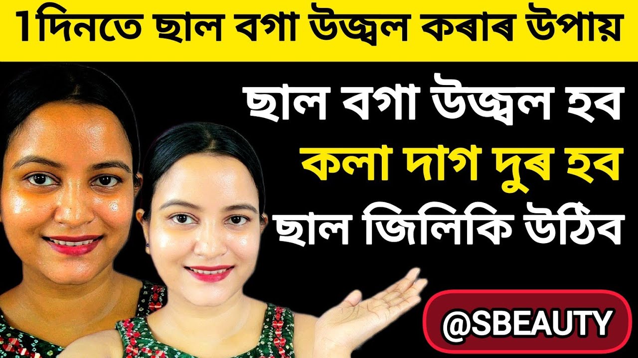 Skin whitening face pack ছাল বগা উজ্বল হব, কলা দাগ শুকান ছাল দুৰ হব, pigmentation- darks spot দুৰ হব