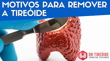 O que acontece se não tomar o hormônio da tireoide?
