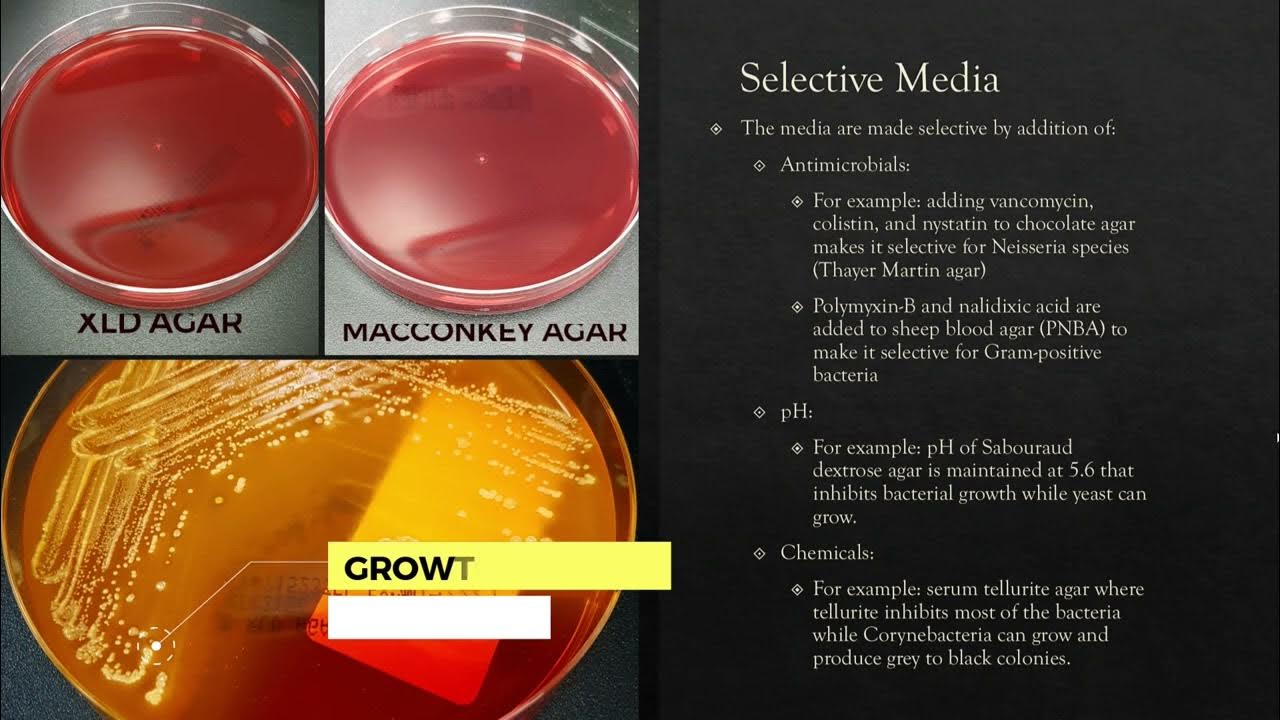 Types of Culture Media used in Diagnostic Microbiology Laboratory