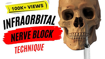 Injection Techniques: Infraorbital nerve block