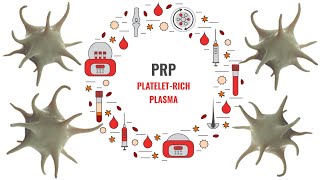 Platelet-Rich Plasma Sketch Video