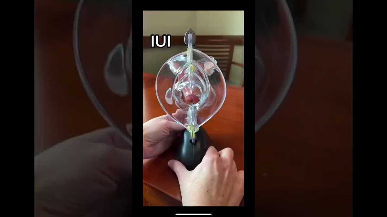 Follow me for more fertility education 