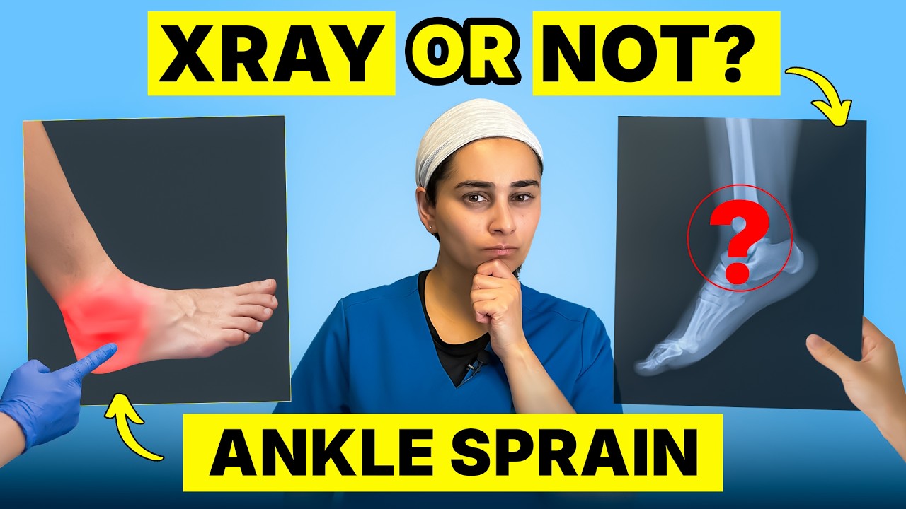 Sprained or Broken Ankle? When Do You Need an X-Ray? | Doctor Explains