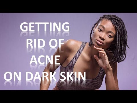 Best Acne Treatment For Black Skin - Acne Treatment For Black Skin - Colloidal silver shop free mart