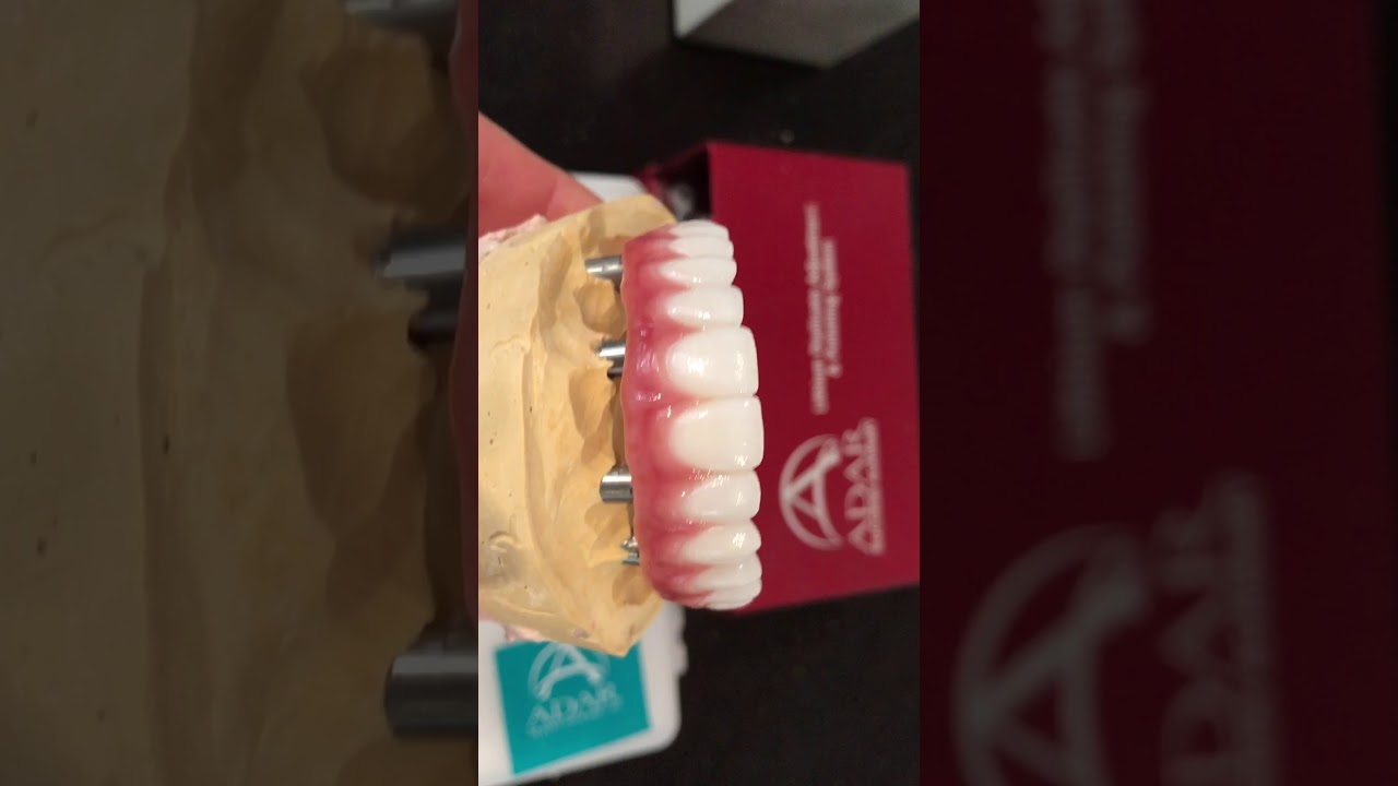 SOLID MONOLITHIC Zirconia Implant Retained Hybrid YouTube