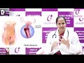 What are the different types of Vaginal Discharge? | Cloudnine Hospitals