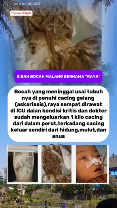 Raya bocah yang meninggal karena didalam tubuh nya di penuhi cacing gelang #viralreels #viralshort