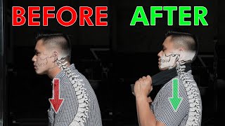 Restore Your Neck Posture & Curve | Cervical Lordosis