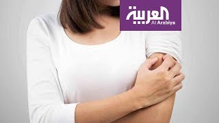 صباح العربية | مشاكل جلدية تسببها حرارة الصيف