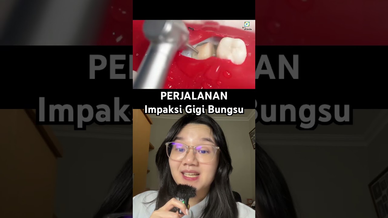 OPERASI GIGI BUNGSU? Serem gak sih?! Ini dia perjalanannya