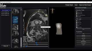 Tutorial #8     How to Segment and Align the VIVO Torso model with an MRI
