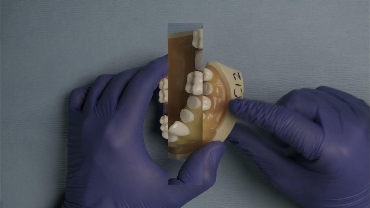 7 Rubber Dam tips you need to know by Dr. Romero YouTube