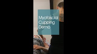 Myofascial Cupping for the Deltoid & Upper Trap