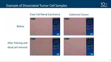 10x-pert Workshop | Characterization of the Tumor Microenvironment with the Chromium Single Cell Imm