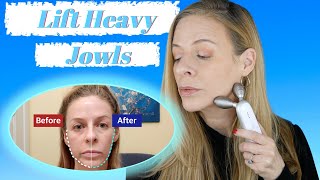 How I Lifted My Heavy Jowls | Medicube | Age R Derma EMS Device | Over 40