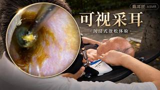 Street Side Ear Cleaning on an Old Man — What Came Out Will Shock You! 👂路上でおじいちゃんの耳掃除をしたら…予想外の結果に！