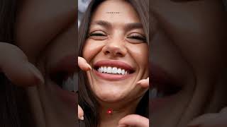 Do veneers damage your natural teeth? 🦷