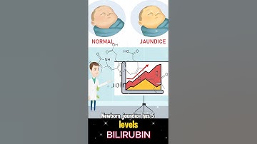 Jaundice in Babies: 5 Stages Every Parent Must Know
