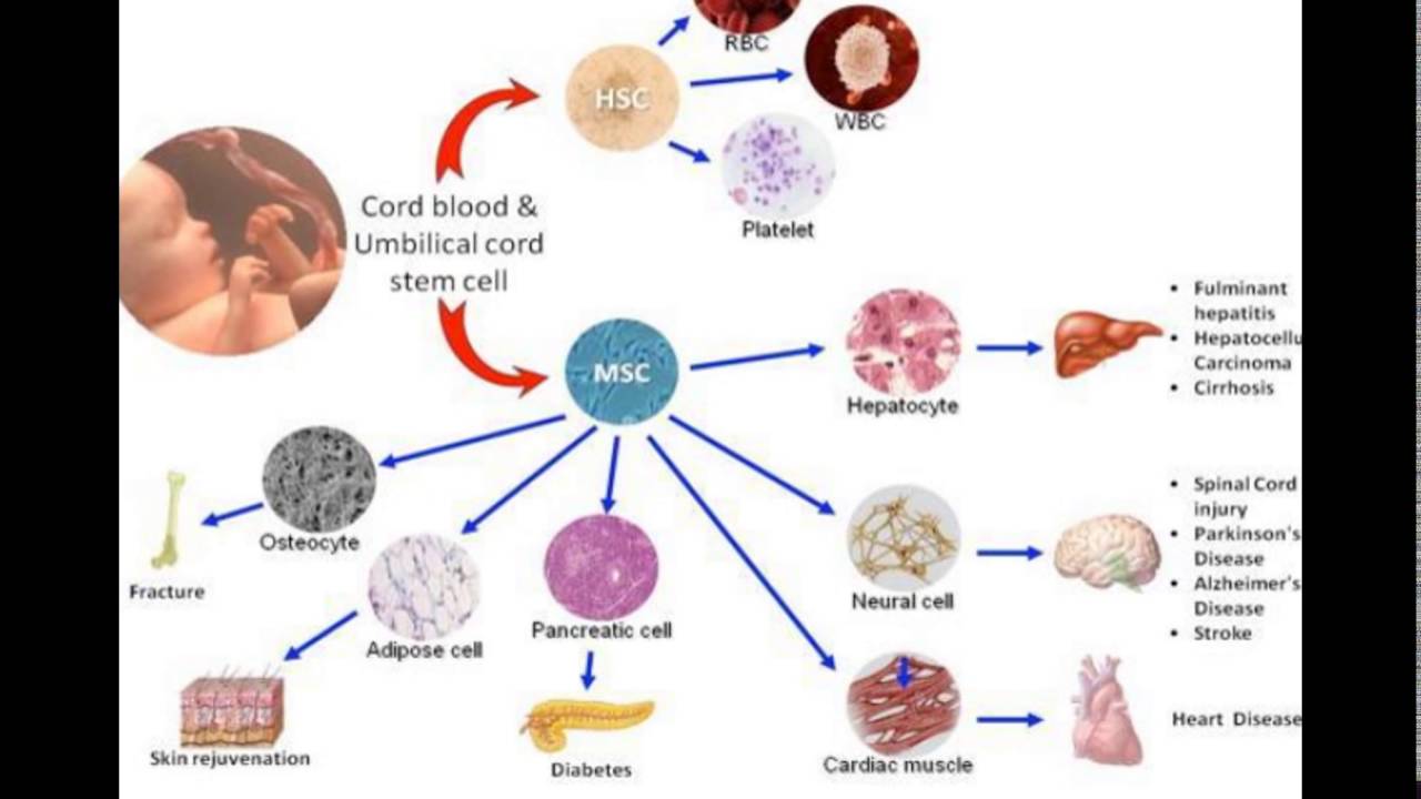 Cord Blood Banking Cost >> Umbilical Cord Blood Banking Cost Cord Blood Banking Cost >> Umbilical Cord Blood Banking Cost