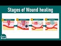 The Stages of Wound Healing Explained