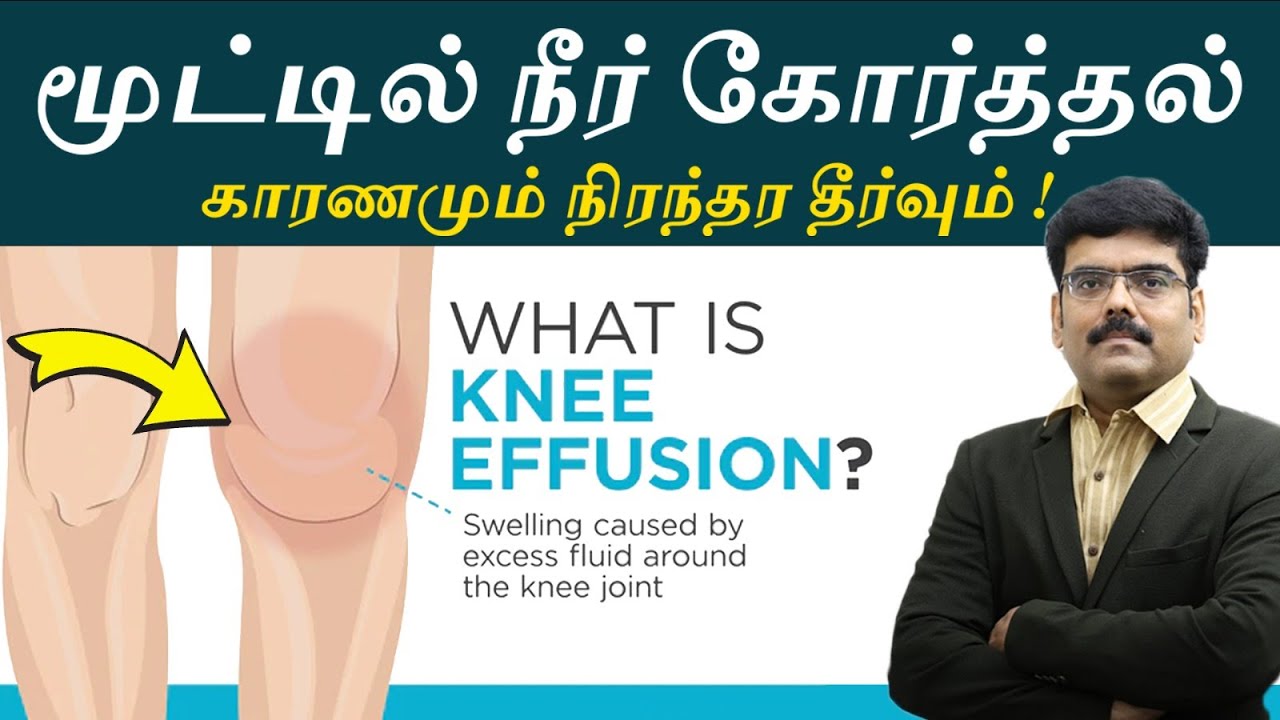 Knee Swelling Causes and Best Solutions -மூட்டில் நீர் கோர்த்தல் மற்றும் மூட்டு வீக்கம் எளிய தீர்வு