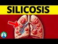 What is silicosis explained 