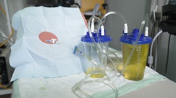 MEP Skills: Paracentesis Daisy Chain