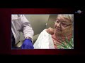 WCW: Draining and Decompressing a Chronic Cyst
