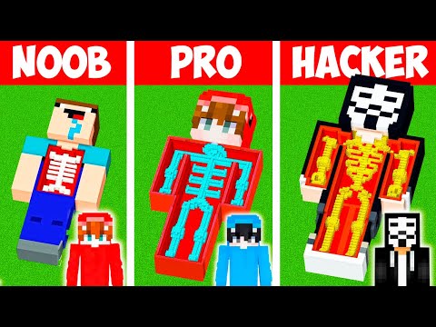 Minecraft NOOB vs
