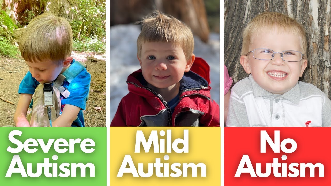 Signs of Mild Autism, Severe Autism, No Autism Compared YouTube