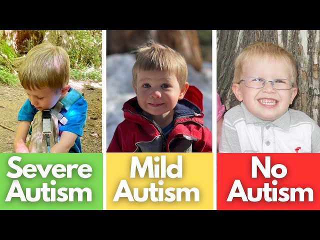 Signs of Mild Autism, Severe Autism, No Autism | Compared class=