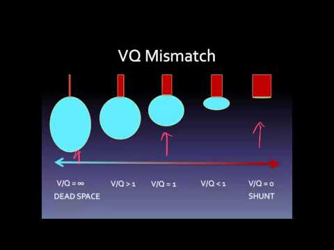 Video: Hypercapnia: Oorzaken, Behandeling En Meer