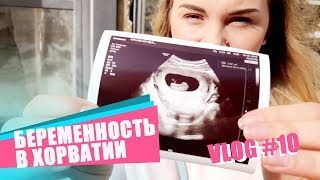 ВЛОГ #10 Беременность в Хорватии / Ведение беременности