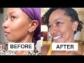 RAW SHEA BUTTER CLEARED MY DARK SPOTS IN 8 DAYS