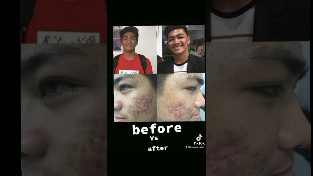 LUXXE White enhanced glutathione